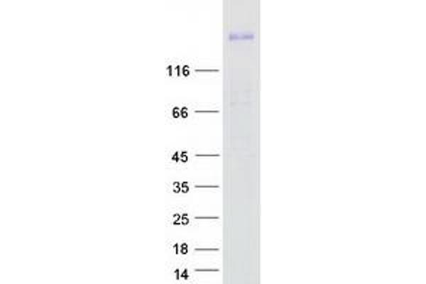 ROBO1 Protein (Transcript Variant 3) (Myc-DYKDDDDK Tag)