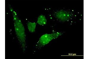 Immunofluorescence of monoclonal antibody to FGFR2 on HeLa cell. (FGFR2 抗体  (AA 621-723))