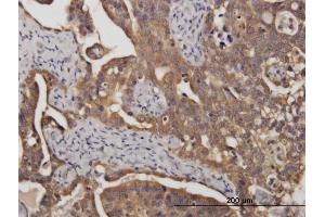 Immunostaining (ISt) image for anti-Stress-Induced-phosphoprotein 1 (STIP1) (AA 1-543) antibody (ABIN524365)