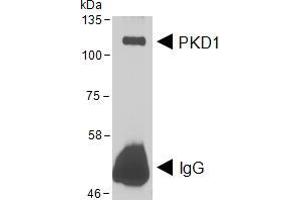 Western Blotting (WB) image for anti-Protein Kinase D1 (PRKD1) (AA 233-246) antibody (ABIN5874190) (PKC mu 抗体  (AA 233-246))