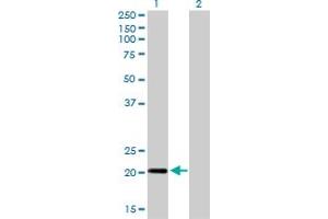 Western Blotting (WB) image for anti-Centrin, EF-Hand Protein, 3 (CETN3) (AA 1-100) antibody (ABIN560341)