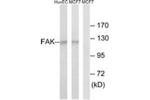 Western Blotting (WB) image for anti-PTK2 Protein tyrosine Kinase 2 (PTK2) (AA 809-858) antibody (ABIN2889088) (FAK 抗体  (AA 809-858))