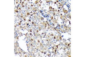 Immunohistochemistry of paraffin-embedded human appendix using KIFC1 Rabbit mAb (ABIN1680485, ABIN3015039, ABIN3015040 and ABIN7101305) at dilution of 1:100 (40x lens). (KIFC1 抗体)