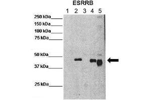 Lanes :  Lane 1: 25ug mouse ES cellsLane 2: 25ug mouse ES cells overexpressing FLAG EsrrB (mouse)Lane 3: 25ug chromatin fraction CV1 cellsLane 4: 25ug chromatin fraction CV1 cells overexpressing FLAG EsrrB (mouse)Lane 5: 25ug chromatin fraction CV1 cells overexpressing FLAG EsrrB-Deltacter (mouse)   Primary Antibody Dilution :   1:500    Secondary Antibody :  Anti-rabbit-HRP   Secondary Antibody Dilution :   1:3000   Gene Name :  ESRRB   Submitted by :  Domenico Maiorano, Institute of Human Genetics (IGH) (ESRRB 抗体  (N-Term))