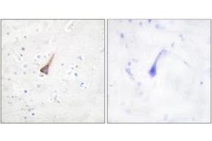 Immunohistochemistry analysis of paraffin-embedded human brain tissue, using PTP1B (Ab-50) Antibody. (PTPN1 抗体  (AA 16-65))