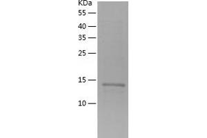 RPS24 Protein (AA 1-130) (His tag)