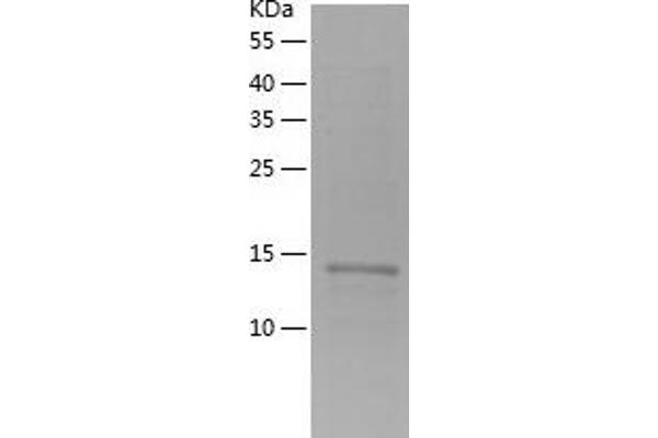 RPS24 Protein (AA 1-130) (His tag)