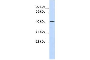 Western Blotting (WB) image for anti-Carboxypeptidase B2 (Plasma) (CPB2) antibody (ABIN2458761) (CPB2 抗体)