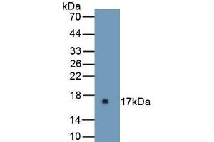 Detection of Recombinant UPK1A, Mouse using Polyclonal Antibody to Uroplakin 1A (UPK1A) (UPK1A 抗体  (AA 116-231))