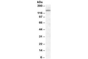Western blot testing of KELLY cell lysate with DLG1 antibody at 0. (DLG1 抗体)