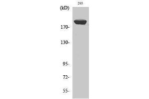 Western Blotting (WB) image for anti-Insulin Receptor Substrate 1 (IRS1) (Ser62) antibody (ABIN3185240) (IRS1 抗体  (Ser62))