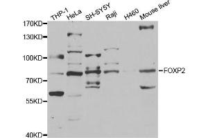 Western blot analysis of extracts of various cell lines, using FOXP2 antibody (ABIN5973317) at 1/1000 dilution. (FOXP2 抗体)