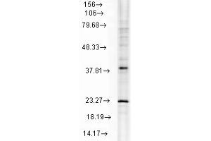 Hsp22 Western Blot. (HSPB8 抗体)