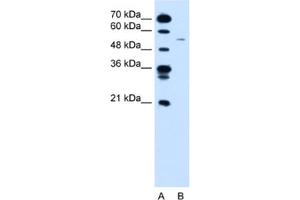 Western Blotting (WB) image for anti-Cyclin B1 (CCNB1) antibody (ABIN2460180) (Cyclin B1 抗体)