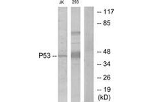 Western Blotting (WB) image for anti-Tumor Protein P53 (TP53) (AA 1-50) antibody (ABIN2889047) (p53 抗体  (AA 1-50))