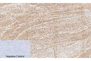 Immunohistochemical analysis of paraffin-embedded human uterus tissue. (CREB1 抗体  (pSer133))