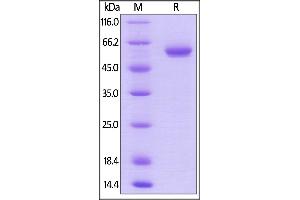 Biotinylated Human BTN3A1, Fc,Avitag on  under reducing (R) condition. (BTN3A1 Protein (AA 30-254) (Fc Tag,AVI tag,Biotin))