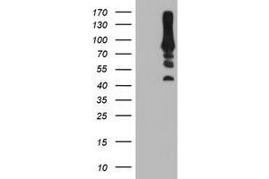 HEK293T cells were transfected with the pCMV6-ENTRY control (Left lane) or pCMV6-ENTRY PFKP (Right lane) cDNA for 48 hrs and lysed. (PFKP 抗体)