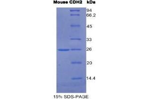 SDS-PAGE analysis of Mouse Cadherin, Neuronal Protein. (N-Cadherin 蛋白)