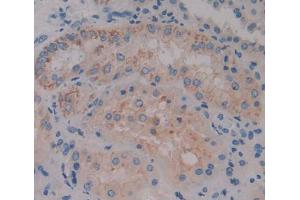 IHC-P analysis of kidney tissue, with DAB staining. (ACOX1 抗体  (AA 210-409))