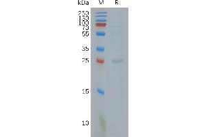 Human C. (CLDN18.2 蛋白)