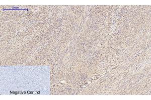 Immunohistochemical analysis of paraffin-embedded human uterus tissue. (IRS1 抗体)