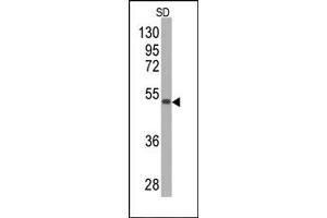Western Blotting (WB) image for anti-Superoxide Dismutase 2, Mitochondrial (SOD2) antibody (ABIN356396) (SOD2 抗体)