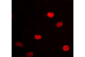 Immunofluorescent analysis of hnRNP D0 staining in HEK293 cells. (HNRNPD/AUF1 抗体  (Center))