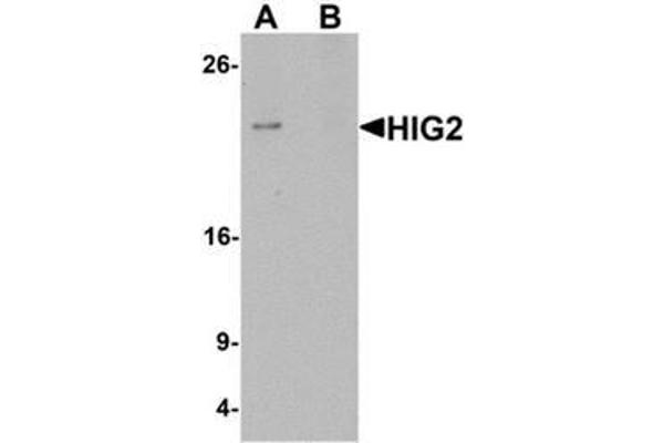 HILPDA 抗体  (C-Term)