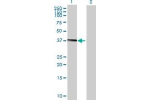 Western Blotting (WB) image for B4GALNT1 293T Cell Transient Overexpression Lysate(Denatured) (ABIN1331900)