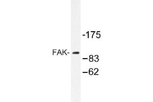 Image no. 1 for anti-PTK2 Protein tyrosine Kinase 2 (PTK2) antibody (ABIN272100) (FAK 抗体)