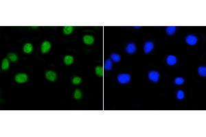 A549 cells were stained with Rb(S807) (2D10) Monoclonal Antibody  at [1:200] incubated for overnight at 4C, followed by secondary antibody incubation and DAPI staining. (Retinoblastoma 1 抗体  (pSer807))