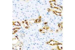 Immunohistochemistry of paraffin-embedded rat kidney using KLK11 antibody. (Kallikrein 11 抗体)