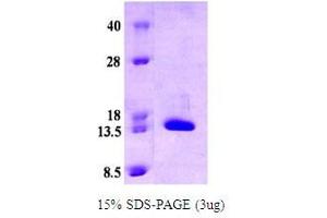 Figure annotation denotes ug of protein loaded and % gel used. (alpha Synuclein DeltaNAC (active) 蛋白)