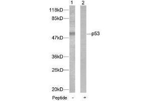 Image no. 1 for anti-Tumor Protein P53 (TP53) (Ser46) antibody (ABIN197253) (p53 抗体  (Ser46))