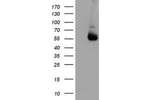 Western Blotting (WB) image for anti-Asparagine-Linked Glycosylation 2, alpha-1,3-Mannosyltransferase Homolog (ALG2) antibody (ABIN1496609) (ALG2 抗体)