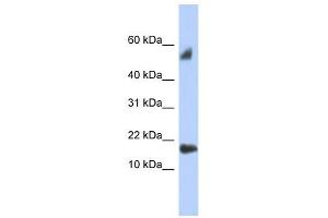 FLJ35767 antibody used at 1 ug/ml to detect target protein. (FLJ35767 (Middle Region) 抗体)