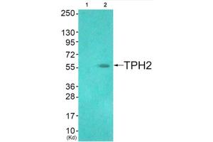 Western blot analysis of extracts from HuvEc cells (Lane 2), using TPH2 (epitope around residue 19) Antibody. (Tryptophan Hydroxylase 2 抗体  (Ser19))
