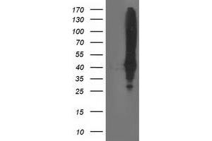 HEK293T cells were transfected with the pCMV6-ENTRY control (Left lane) or pCMV6-ENTRY MSI1 (Right lane) cDNA for 48 hrs and lysed. (MSI1 抗体)