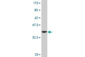 Western Blot detection against Immunogen (37. (ZNF281 抗体  (AA 787-893))