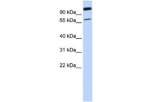 WB Suggested Anti-LST-3TM12 Antibody Titration:  0. (LST-3TM12 抗体  (Middle Region))