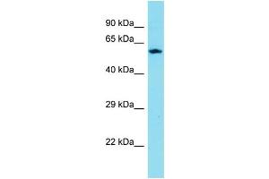 Host: Rabbit Target Name: CXXC11 Sample Type: ACHN Whole cell lysates Antibody Dilution: 1. (CXXC11 抗体  (C-Term))