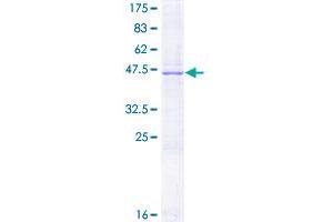 Image no. 1 for Protein C Receptor, Endothelial (PROCR) (AA 1-238) protein (GST tag) (ABIN1316360) (PROCR Protein (AA 1-238) (GST tag))