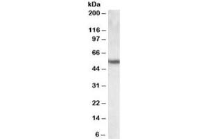 Western blot testing of human lung lysate with Cytokeratin 13 antibody at 0. (Cytokeratin 13 抗体)
