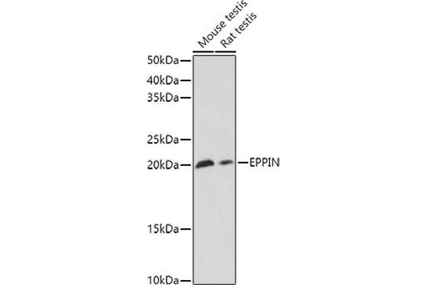 Eppin 抗体  (AA 22-133)