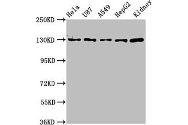 SLC12A2 抗体  (AA 110-282)