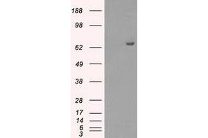 HEK293T cells were transfected with the pCMV6-ENTRY control (Left lane) or pCMV6-ENTRY HDAC10 (Right lane) cDNA for 48 hrs and lysed. (HDAC10 抗体)