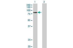 Western Blotting (WB) image for ADAM12 293T Cell Transient Overexpression Lysate(Denatured) (ABIN1334038)