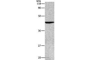 Western blot analysis of Hela cell, using APG4B Polyclonal Antibody at dilution of 1:500 (ATG4B 抗体)