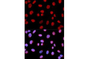 Immunofluorescence (IF) image for anti-Minichromosome Maintenance Complex Component 6 (MCM6) (AA 562-821) antibody (ABIN6219105) (MCM6 抗体  (AA 562-821))